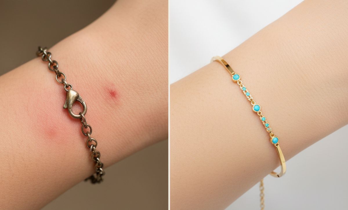 Comparison of nickel allergy reaction from metal bracelet versus safe nickel-free gold jewelry for sensitive skin